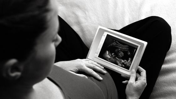 black and white photograph of lady looking at her scan photo shot over her shoulder style